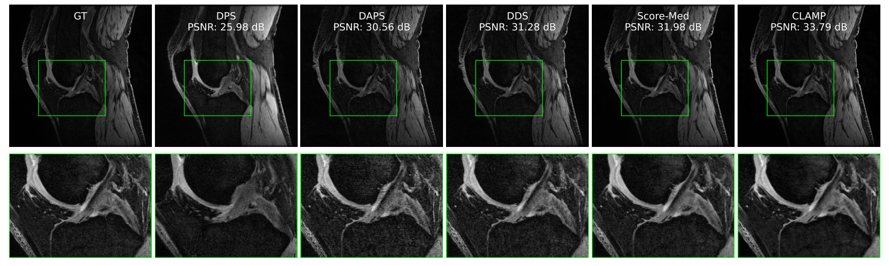 Qualitative MRI reconstruction comparison showing ground truth and reconstructions from DPS, DAPS, DDS, Score-Med, and CLAMP.